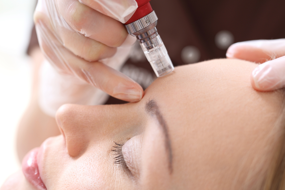 Mesoplus Treatment